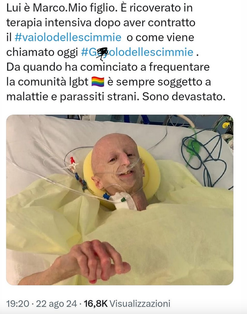 Il vergognoso post omofobo sul vaiolo delle scimmie con la foto di Sammy Basso