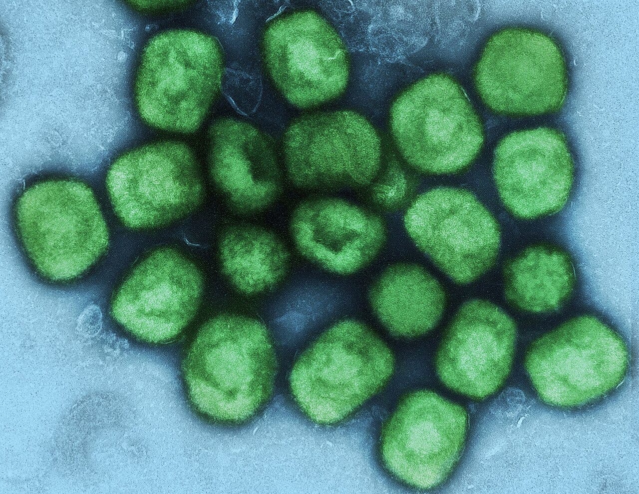 Virioni di MPXV fotografati al microscopio elettronico. Image credit: National Institute of Allergy and Infectious Diseases (NIAID)